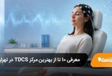 معرفی 10 تا از بهترین مرکز TDCS در تهران